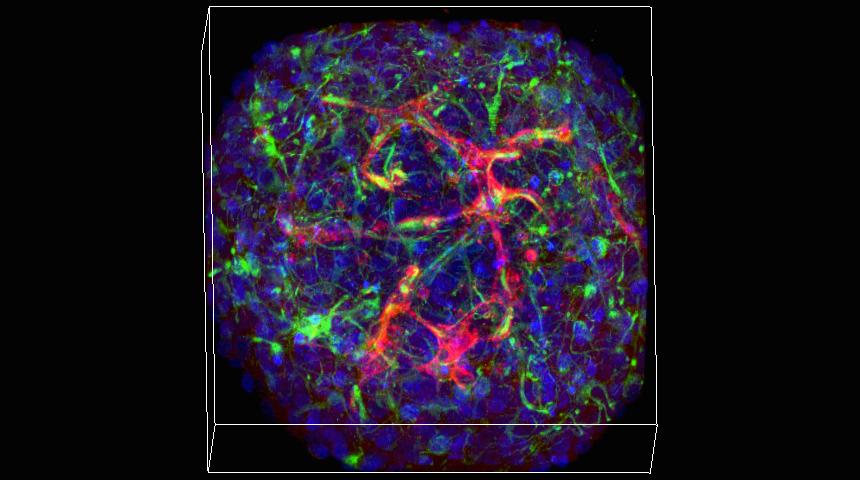 NeuralCell's tweet photo. With mini-vessels, mini-brains expand research potential @BrownUniversity https://t.co/BV9DfGwICn https://t.co/bAhIYTUiKY