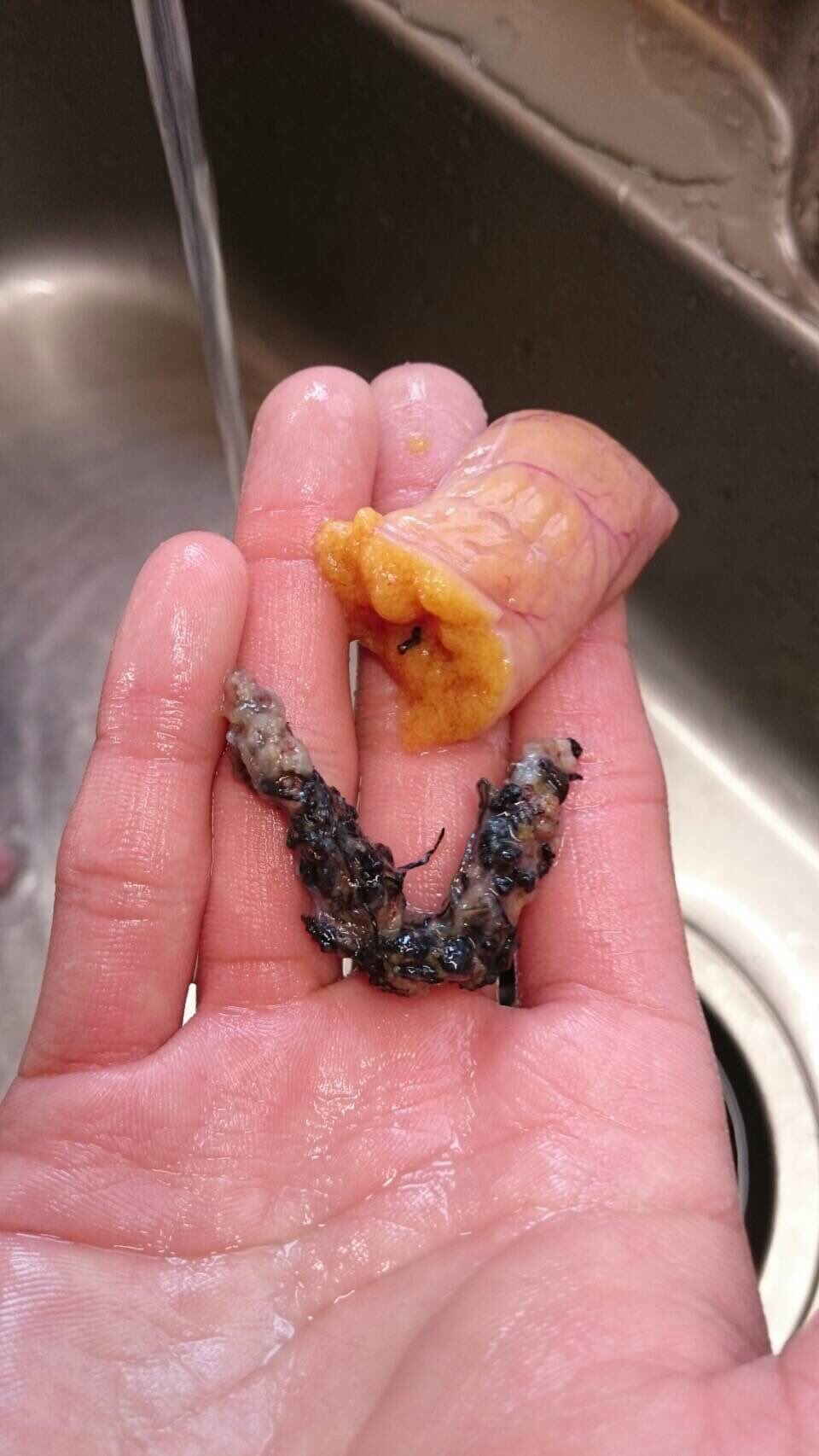 K 先日釣った魚を捌いたのですが 卵に黒い物体がありました 以前にランカーを釣った際にもあったのですが 大型化すると必然的に生じるものなのでしょうか 写真4枚目の上 下はフッコサイズの卵 この現象の詳細についてご存知の方はいらっしゃいますか