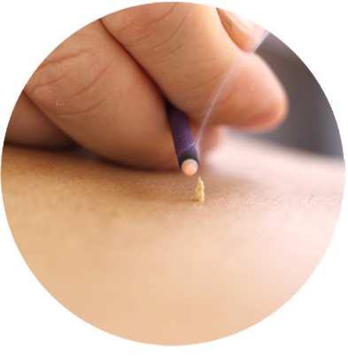 acurate_site's tweet photo. https://t.co/lJDqQsUjcU Avi Magidoff is sharing an amazing step by step treatment approach for sensitive #scars.  #acupuncture #acurate https://t.co/GO4sMUfXfC
