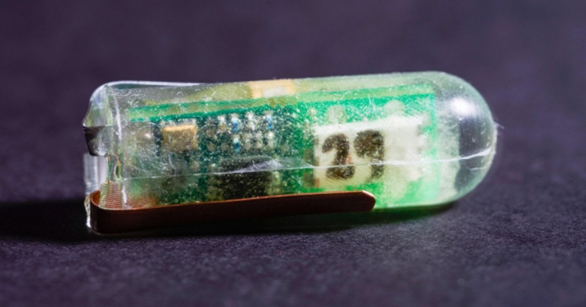 ios_plc's tweet image. Gut feeling: Researchers develop medical sensors powered by stomach acid dlvr.it/NKrslw #Tech