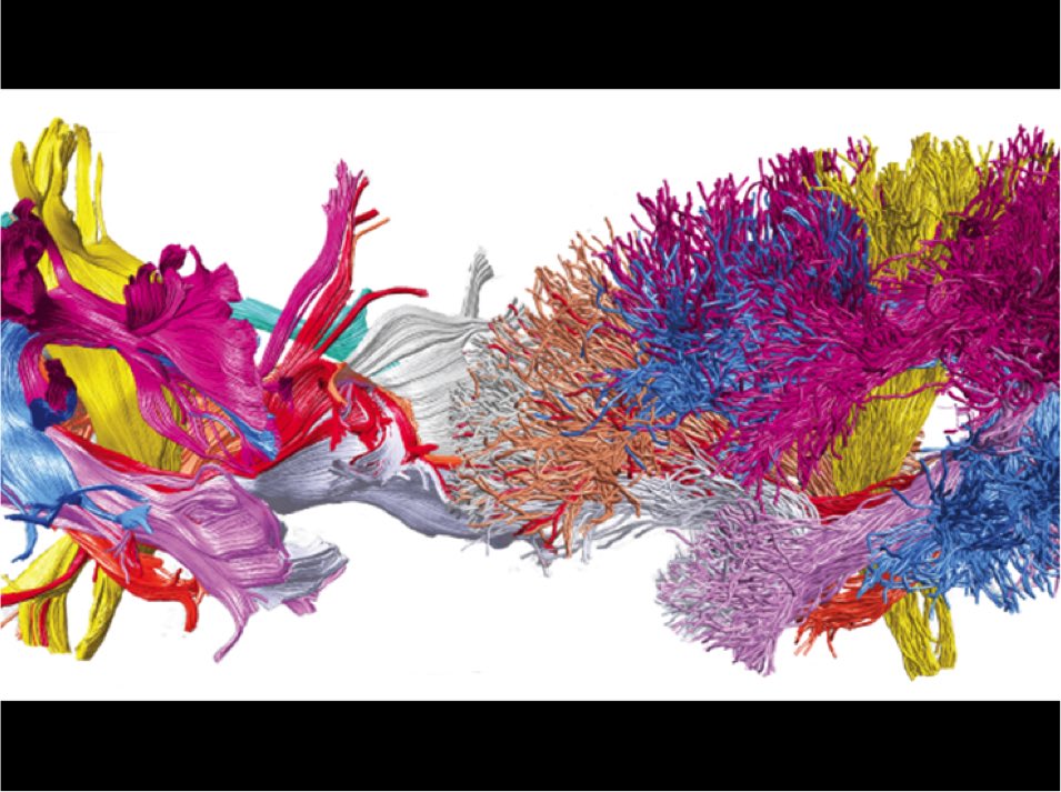 In this image the colors represent white matter pathways that allow parts of the #brain to communicate w each other: bit.ly/2kAgNtg