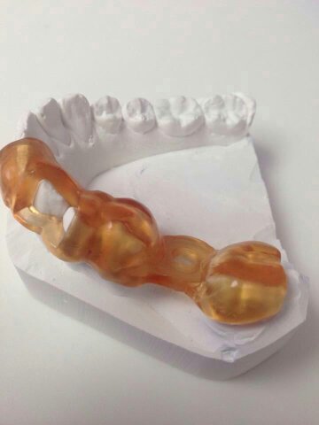 meccatronicore's tweet photo. #BBCure Dental è il fornetto UV per stampanti #3D progettato per l'asciugatura dei tuoi prodotti dental https://t.co/EGYpk7bcDA https://t.co/MySbEsrptS