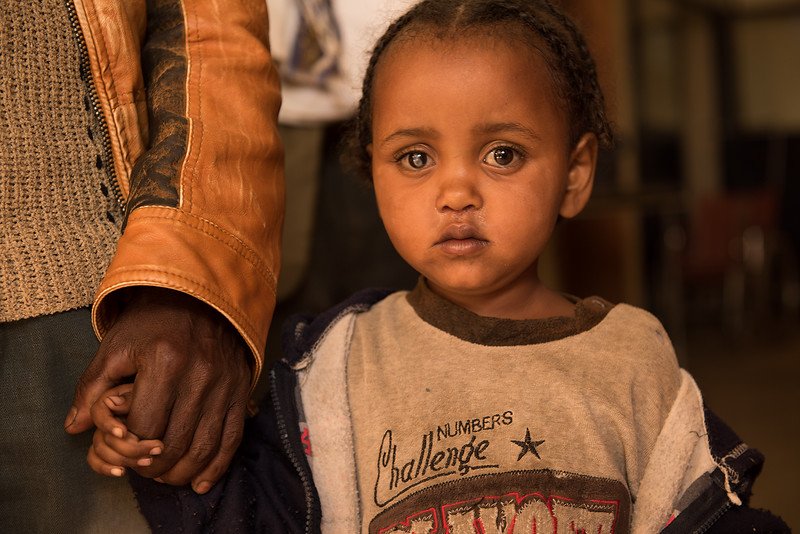 WEEMAintl's tweet photo. Cataract:a clouding of the eye's lens. You can be born w or develop one thru aging, eye injury or disease @CureBlindness @WHO #CataractFacts https://t.co/S5nxL3dQXn