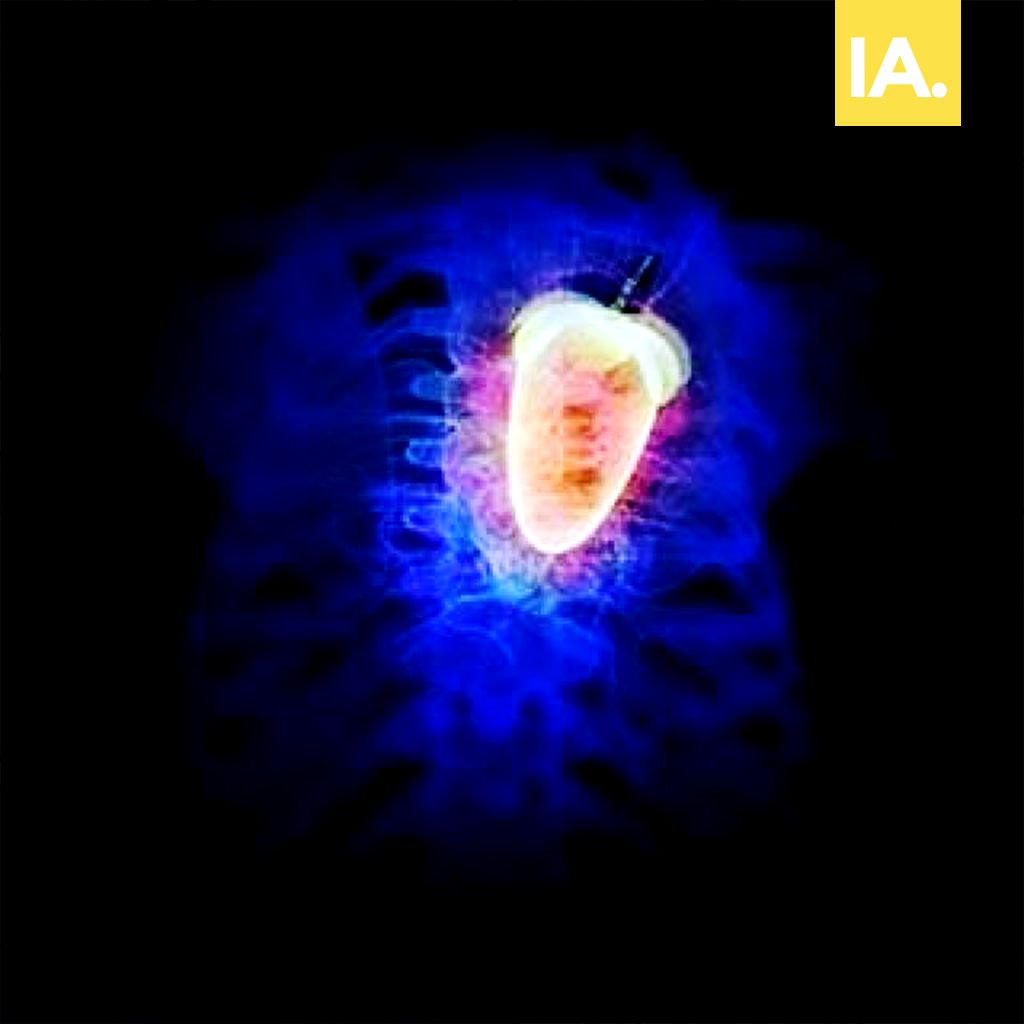 Insideaudio tweet media