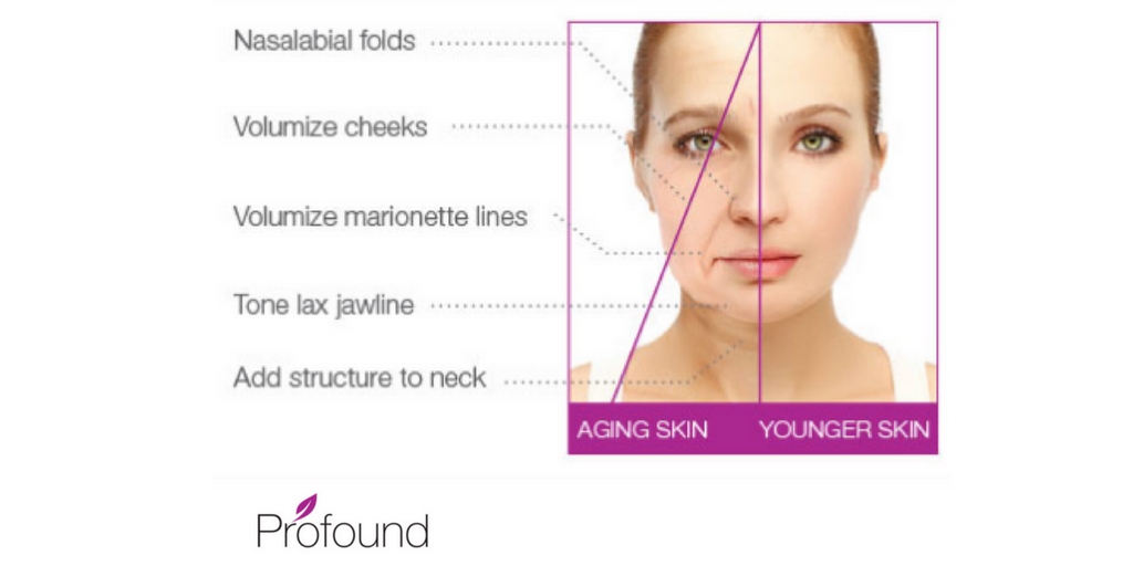 ProfoundLift's tweet image. Do something today that your future self will thank you for, treat yourself to your first Profound Lift® treatment! bit.ly/2depN2y