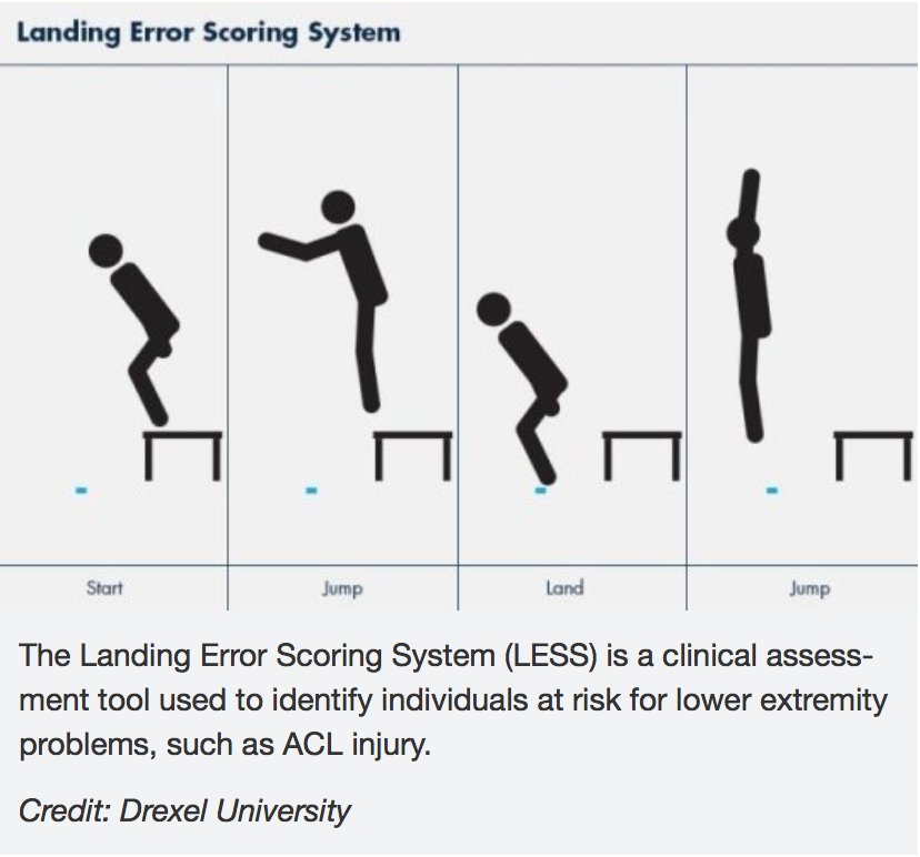 Bill Phillips (@billphillipsmh) on Twitter photo A new way to predict and prevent ACL injuries among youth soccer players. cc <a href="/LVUnited/">Lehigh Valley United</a> <a href="/EmmausSoccer/">Emmaus Girls Soccer</a> ow.ly/PU1w308QpQG A new way to predict and prevent ACL injuries among youth soccer players. cc <a href="/LVUnited/">Lehigh Valley United</a> <a href="/EmmausSoccer/">Emmaus Girls Soccer</a> ow.ly/PU1w308QpQG