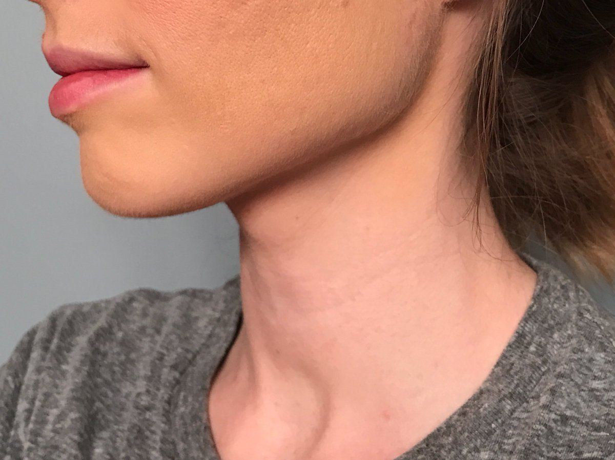 TiffanyHMUA's tweet photo. @PFCosmetics "Translucent" airbrush pressed powder + "Translucent Light" airbrush loose powder both NOT translucent &amp; oxidize. https://t.co/bgV6S8dSSz