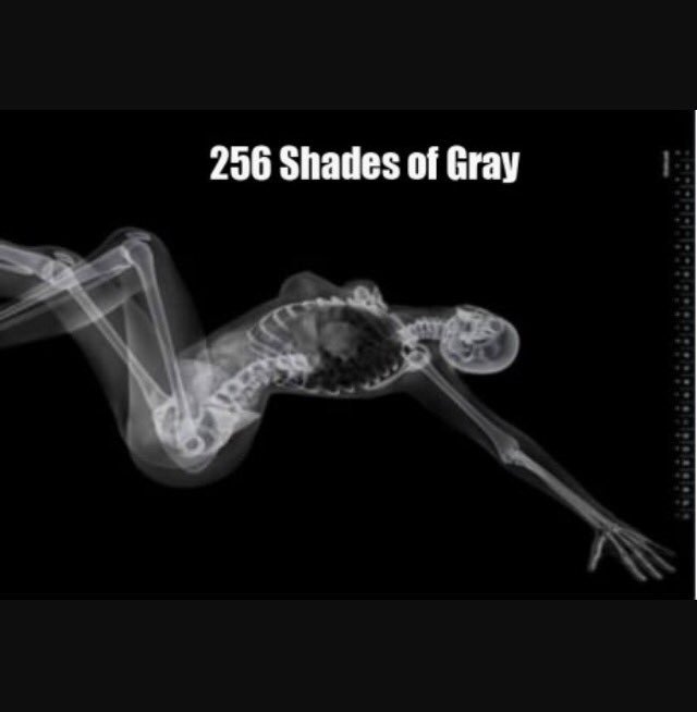 averymichaels_'s tweet photo. I just have to re-share this! @ellelljaytoo reminded me. #xrayhumor https://t.co/C2NbfBjhwN