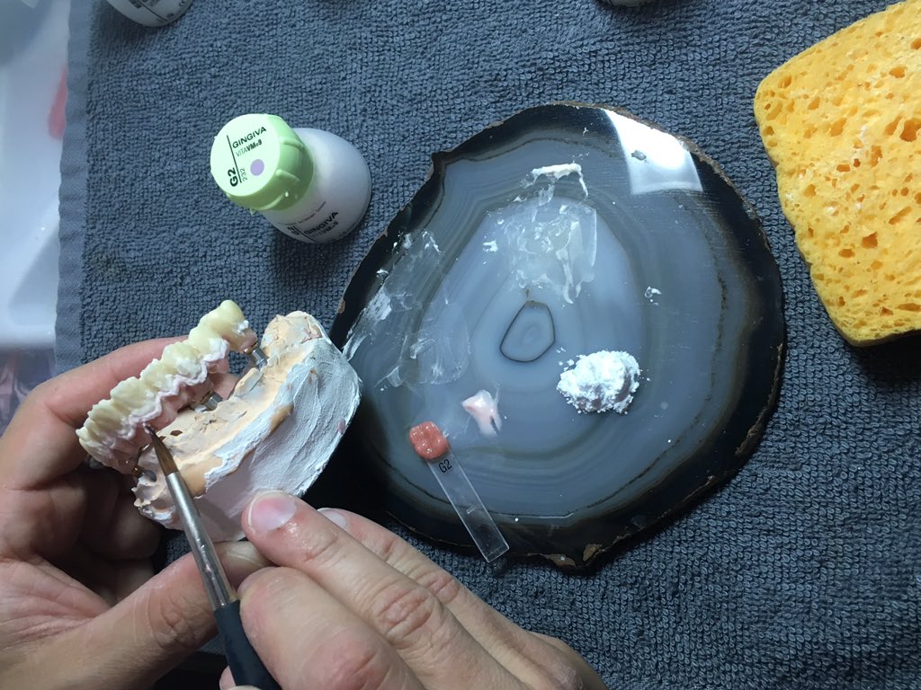 Ernesto_VITA's tweet photo. Working on 🚧#YZHT #circonio #vitacadcam #shadeliquids #VM9 #akzentplus #dental #denstagram #dental @VITA_Zahnfabrik @RenfertDental https://t.co/q3ZxZS2mMc