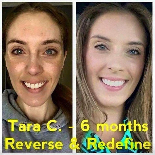 I get to help people get the beautiful skin they deserve.  Message me and we can figure out which are right for you. #Rodan&amp;Fields