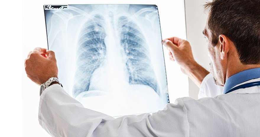 Okudunuz mu? Kan testi ile akciğer kanserinin erken teşhisi mümkün olacak! dlvr.it/NL9ZwB #7saniye #Saglik