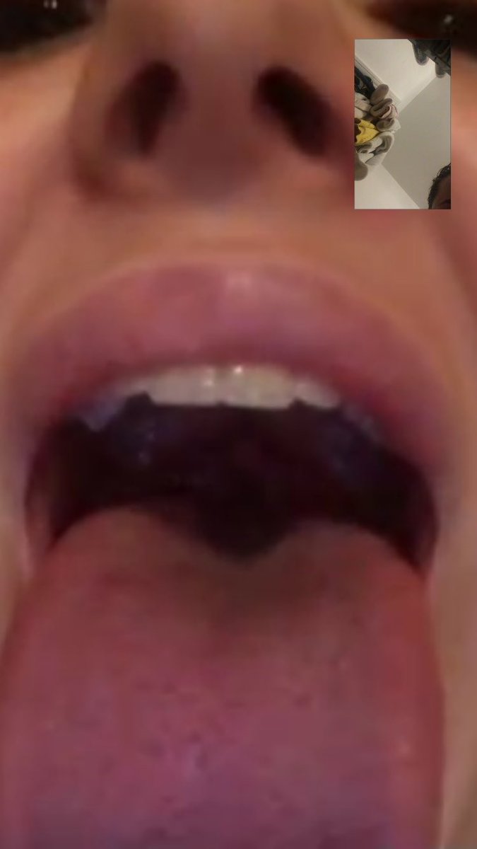 nicolegavin3's tweet photo. R.I.P @lauraminajxoxo tonsils you done good baby girllll 👑👑 xxx https://t.co/gxqw2Pz2Ad