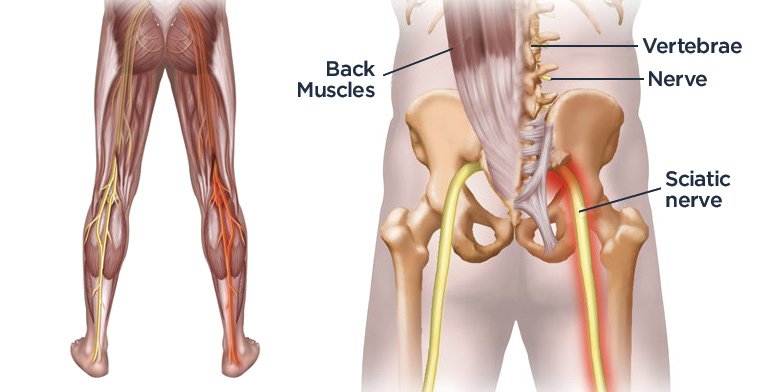 YogaPeopleIO's tweet photo. Great article and great stretches - 7 Poses to Soothe #Sciatica |via  @YI_Mag #backpain #yoga https://t.co/NXfZfjRxQi https://t.co/MCPKe6adiO
