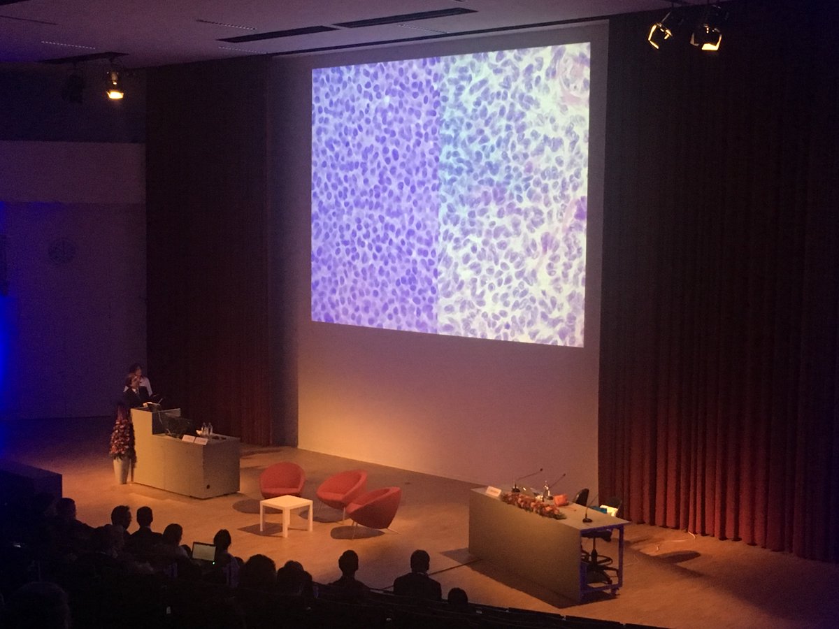 hanine_fourie's tweet photo. The 'simple rules' of histopathology (granulosa cell tumour) by Dr Gian Franco Zannoni. #iota2017 #kuleuven https://t.co/RDgLhqyY4j