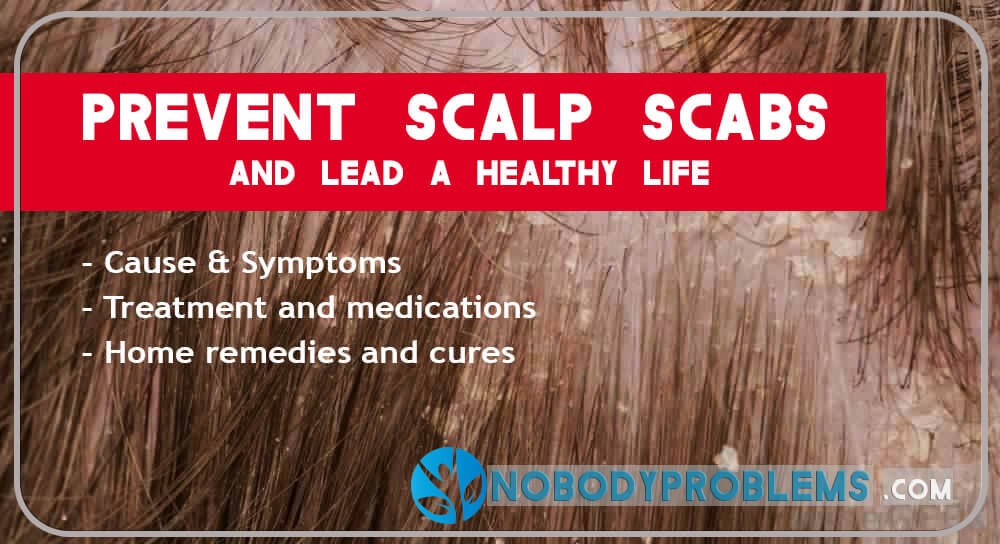 nobodyproblems's tweet photo. How to Get Rid of Scabs on Scalp
https://t.co/QKAAXaMqlg
#scalp_scabs #hair #haircare https://t.co/kt0G8Lor6W