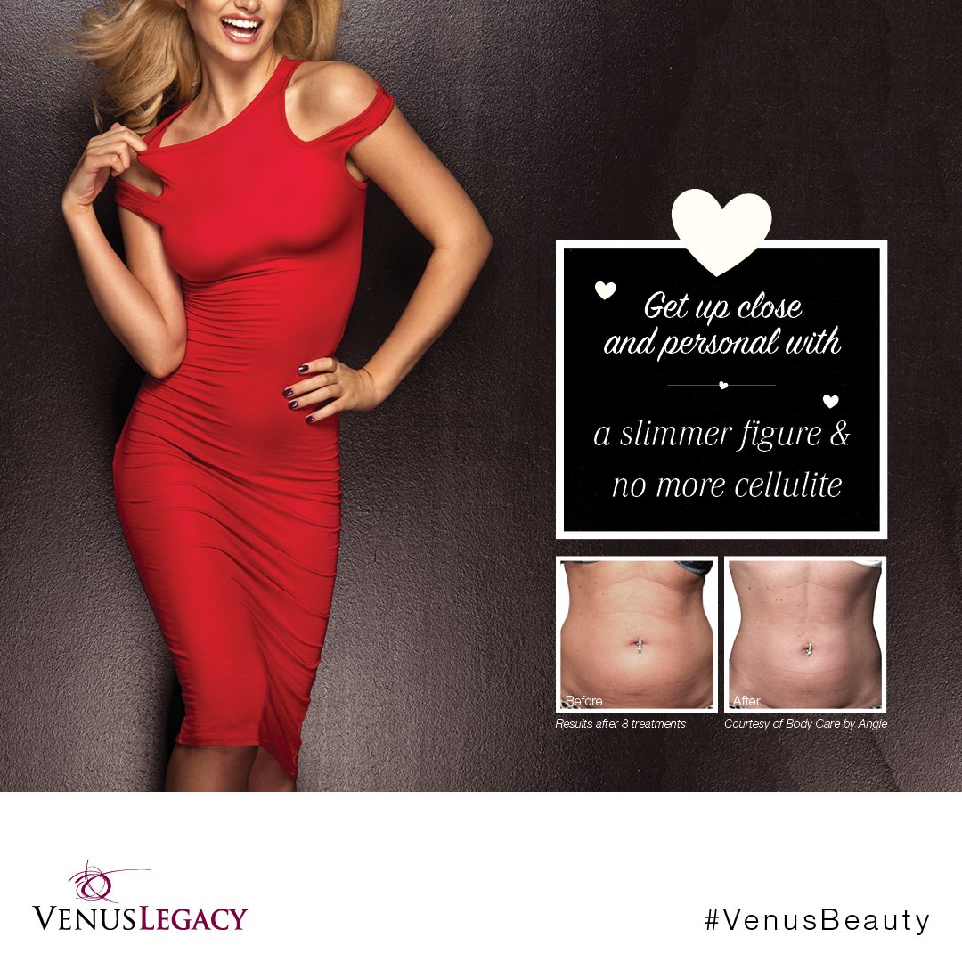 trigenicscanada's tweet photo. Feel and look your best for your valentine with our new Venus Legacy treatments! Call to book a free consultation now! 416-481-1936 https://t.co/Ip9vUj2uoO