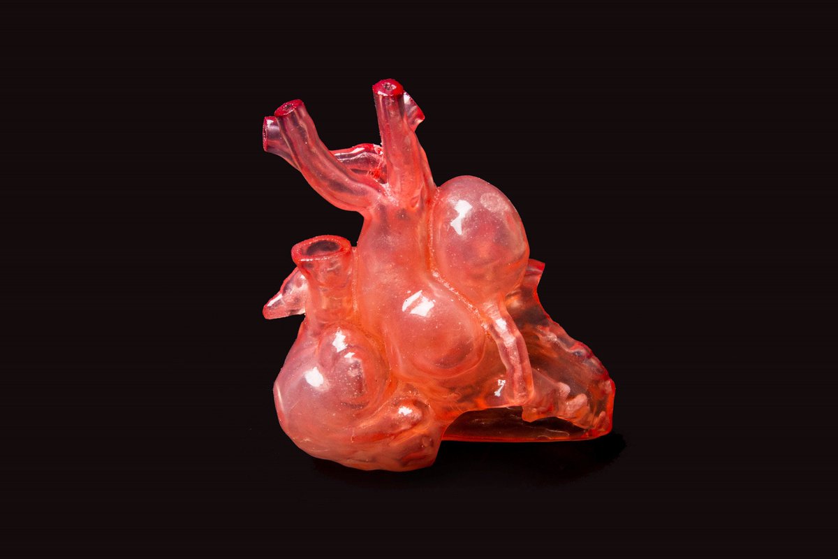 MaterialiseNV's tweet photo. Read all about our partnership with @Carestream and @SiemensHealth on AnatomyPrint at #RSNA2016 https://t.co/98pYgq1Qn0 https://t.co/Q9kJIXPwnt