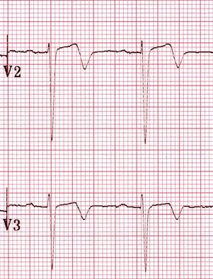 Taylor Pomeranz tweet media