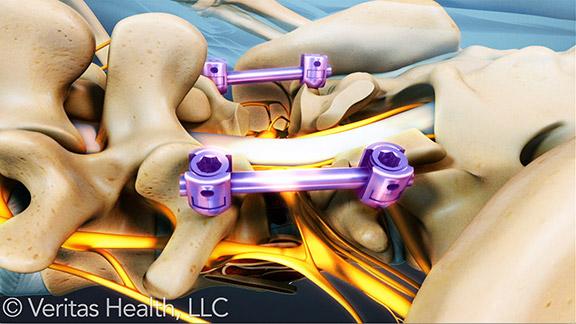 CESSpine's tweet photo. Essential Items for #BackSurgery Recovery @SpineHealth https://t.co/q6Mz9Gz0tx https://t.co/YATZd1OhCH