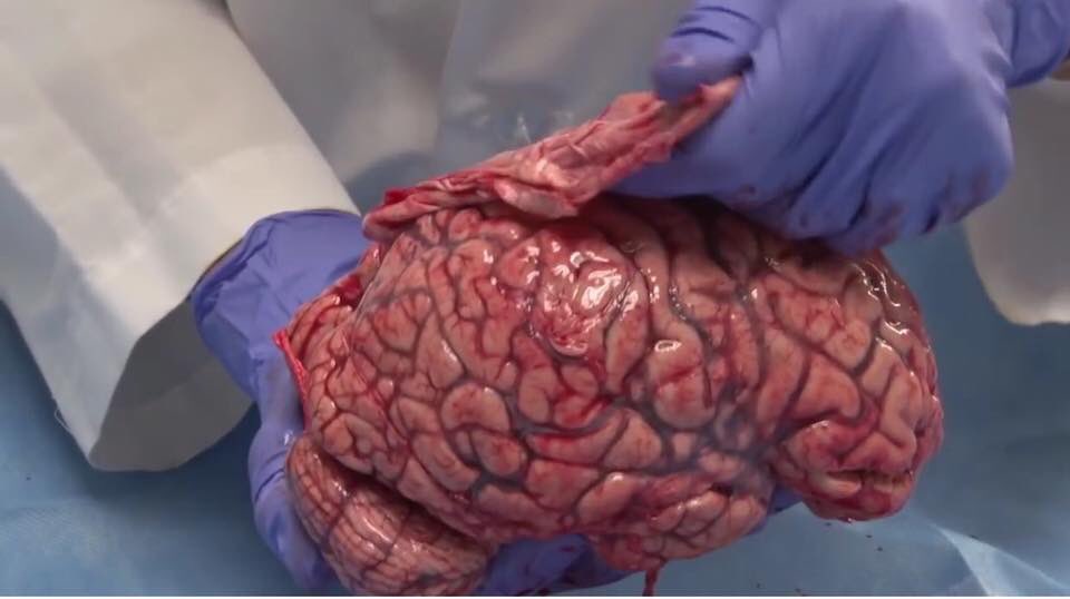 sirdanyal's tweet photo. the human brain https://t.co/GYOy09OsKy