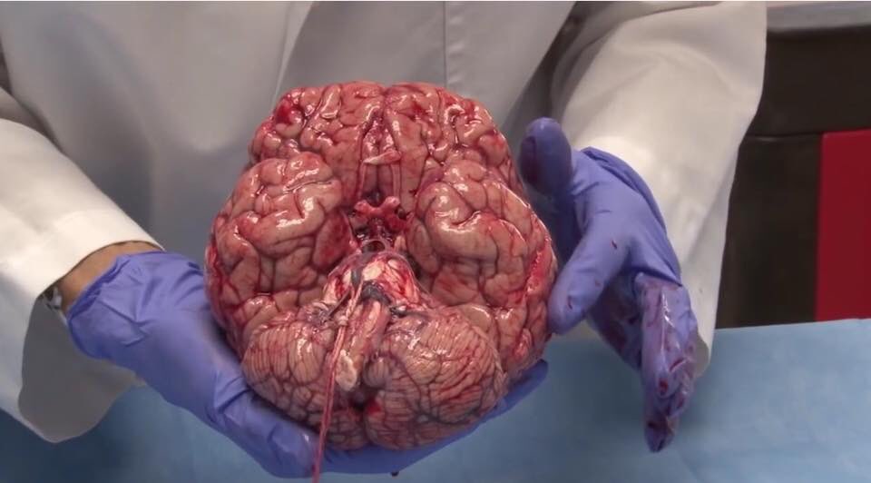 sirdanyal's tweet photo. the human brain https://t.co/GYOy09OsKy