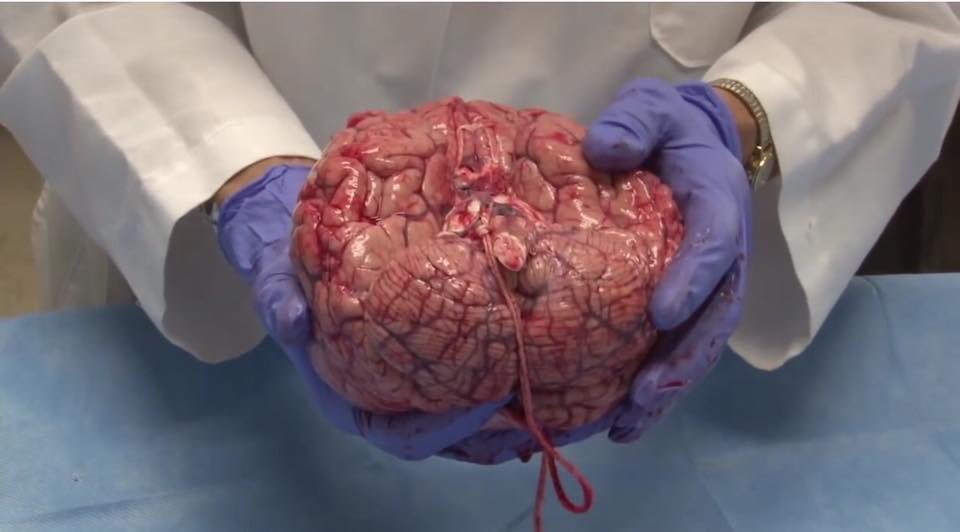 sirdanyal's tweet photo. the human brain https://t.co/GYOy09OsKy