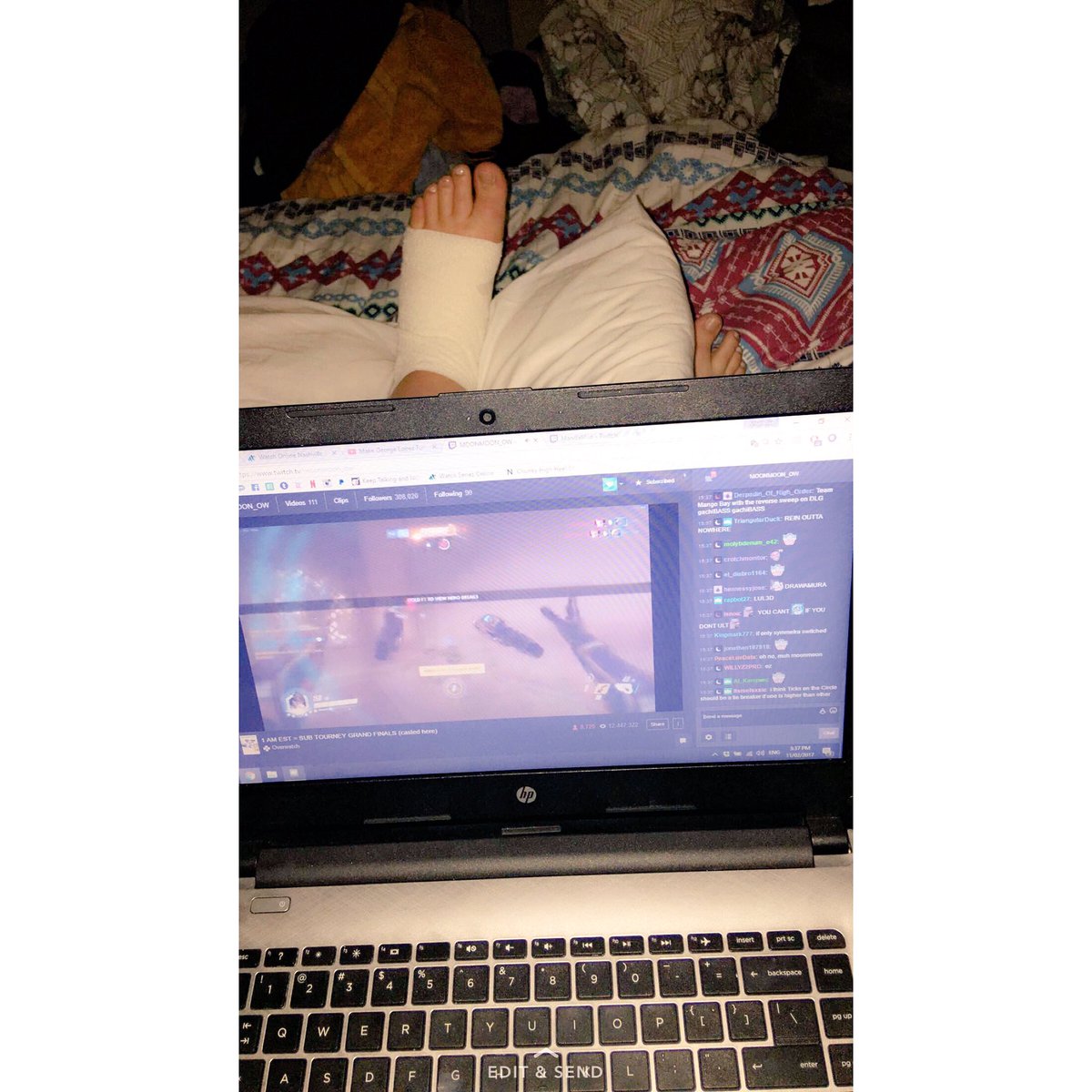 MandaMilo's tweet photo. Out of work for the next week at least because I'm a fucking moron.
Someone end me please. ๐๐๐#hazardtomyself #chubbytoes https://t.co/TttW7YFn86