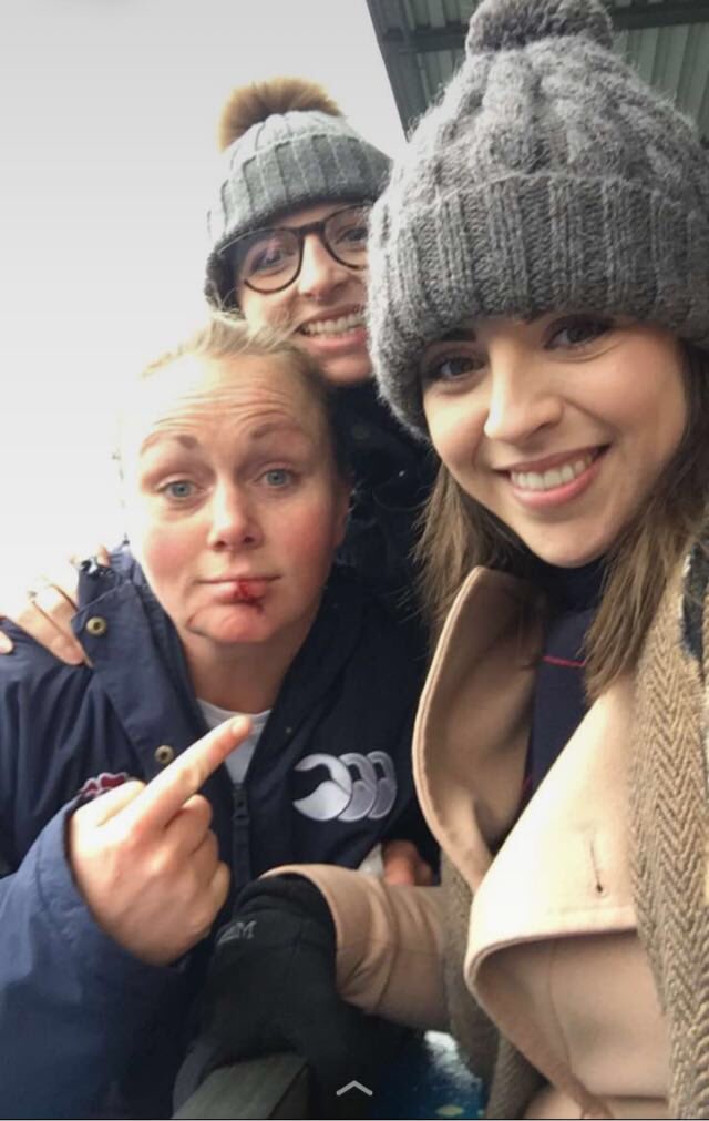 ParagonBath's tweet photo. 63-0 Success @SixNationsRugby in Cardiff for #redroses @izzynoelsmith shows her supporters her injuries #GoSnowFish https://t.co/N0zhjOfPsW