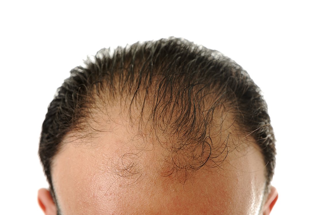 CONFIRMED: This is the one protein you need to eat to stop hair loss. http://bit.ly/2knQqWK