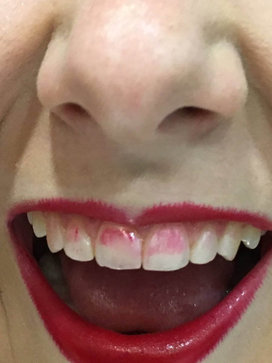 RellaSalgarella's tweet photo. il mio sorriso preferito #alepegopigi https://t.co/HVKzJ5AzLC