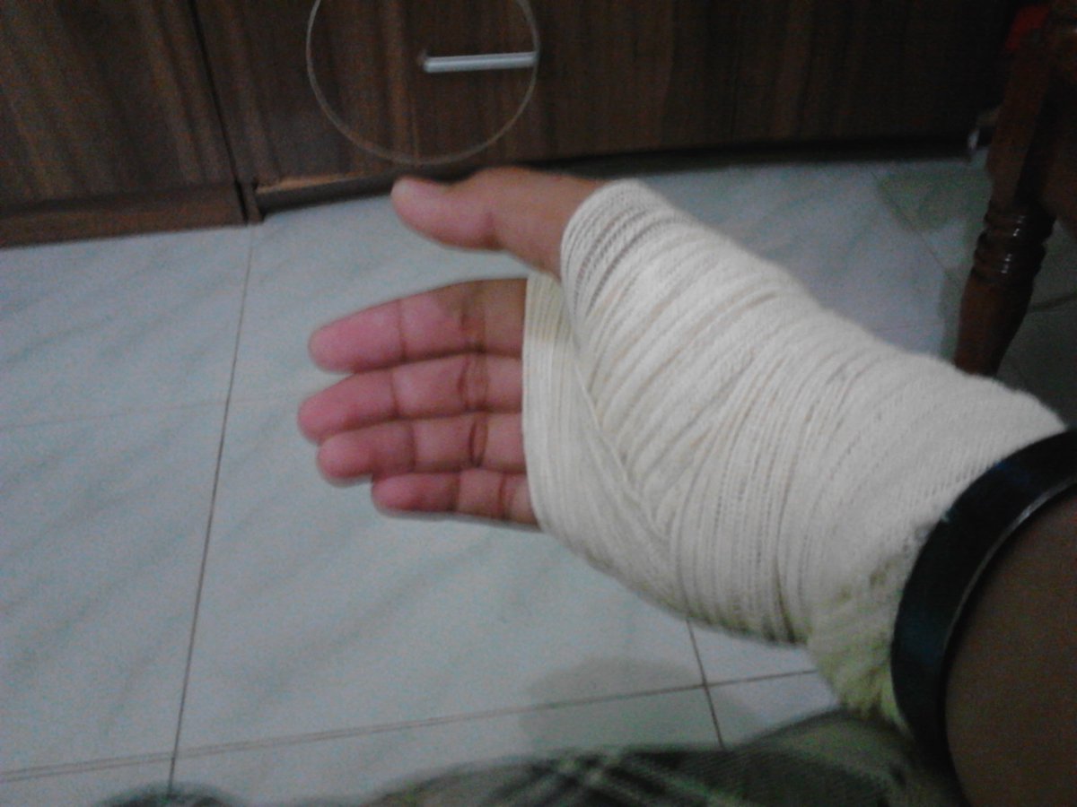 cjlabalan's tweet photo. Fuck.!!!!
#injury
#midfing https://t.co/W3kOHFNk8o