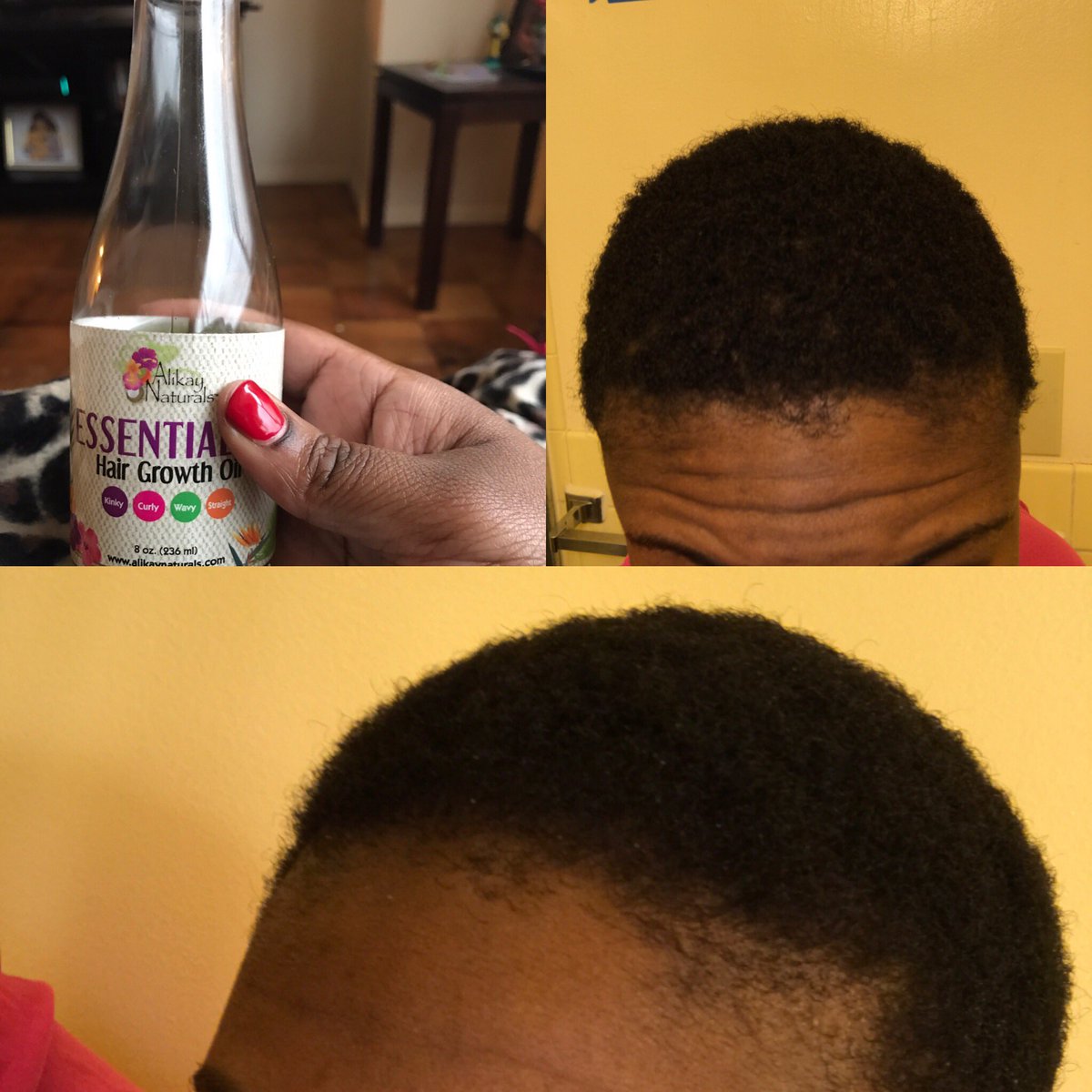 TurquoiseJBrown's tweet photo. Oiling my hair on this Sunday afternoon 🙆🏾with my favorite @BlackOnyx77 @AlikayNaturals #NaturalHairGrowth https://t.co/1rNZeGE5O4