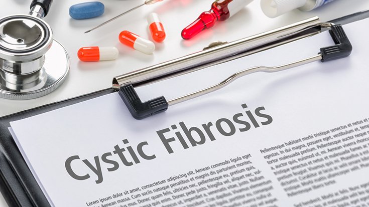 aarc_tweets's tweet photo. Researchers have developed a new set of guidelines that widen the diagnostic criteria for #CysticFibrosis. https://t.co/agvhPp3t5v https://t.co/Vc4VQh99jo