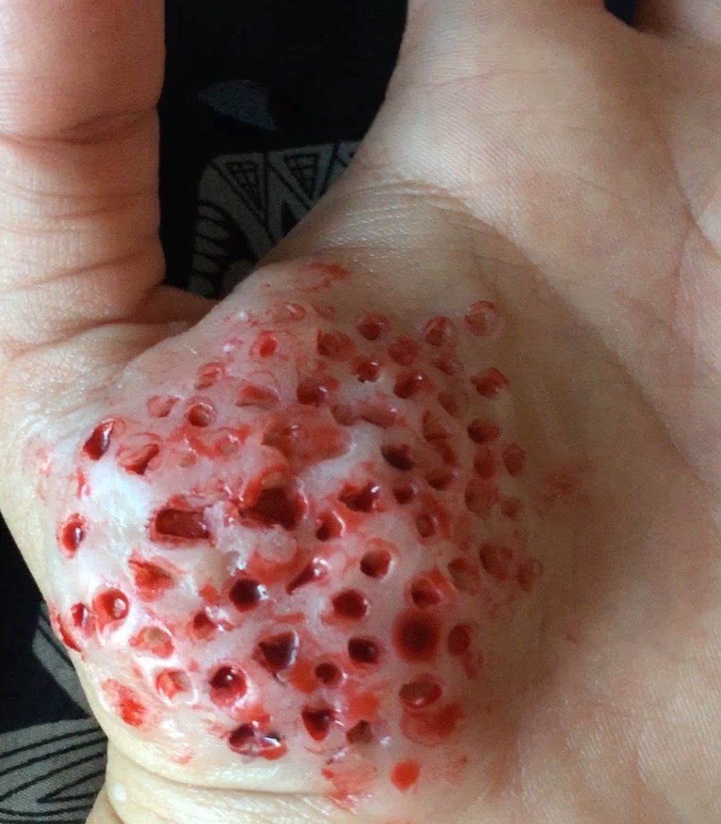 WhiteZunder 🦊 tweet media