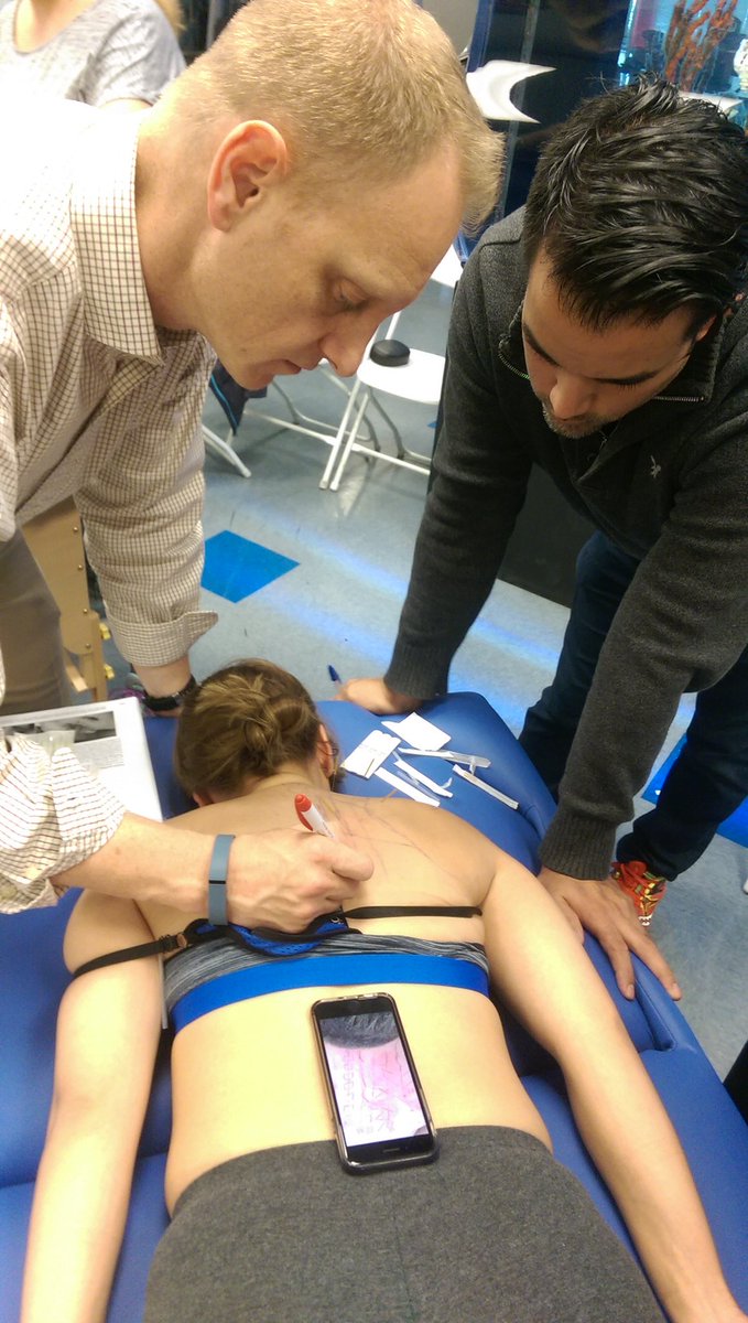 CalebKauffmann's tweet photo. .@EPdrNate describes #dryneedling treatment for myofascial pain of the upper back and scapula @ncolon07  @RayButtsDPTPhD @DrDunning https://t.co/QyiDkRIkXK