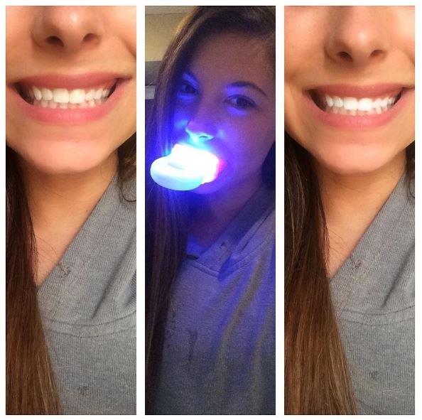 FSTanning's tweet photo. Get that perfect smile just in time for #ValentinesDay with @TwilightTeeth https://t.co/b5hTc60T9R