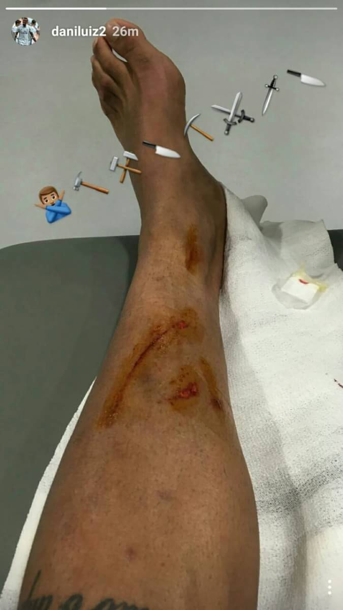 Semoga segera membaik <a href="/2DaniLuiz/">Danilo Luiz</a> 😓😥💪

#MadridMalang