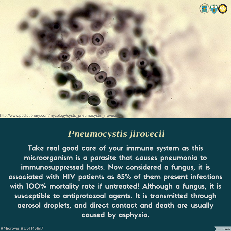 UST_MicroSoc's tweet photo. #Microvia #TheMoreYouKnow #USTMS1617 https://t.co/PVpY5JvKXj