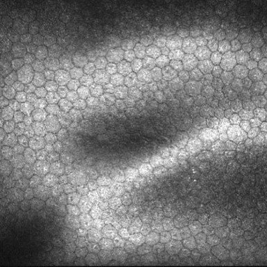 IOM_Mallorca's tweet photo. Resolvemos las dudas más comunes sobre la #MicroscopiaConfocal, consulta el situiente artículo https://t.co/VzCtyd75PX https://t.co/rShgmgJ2zD