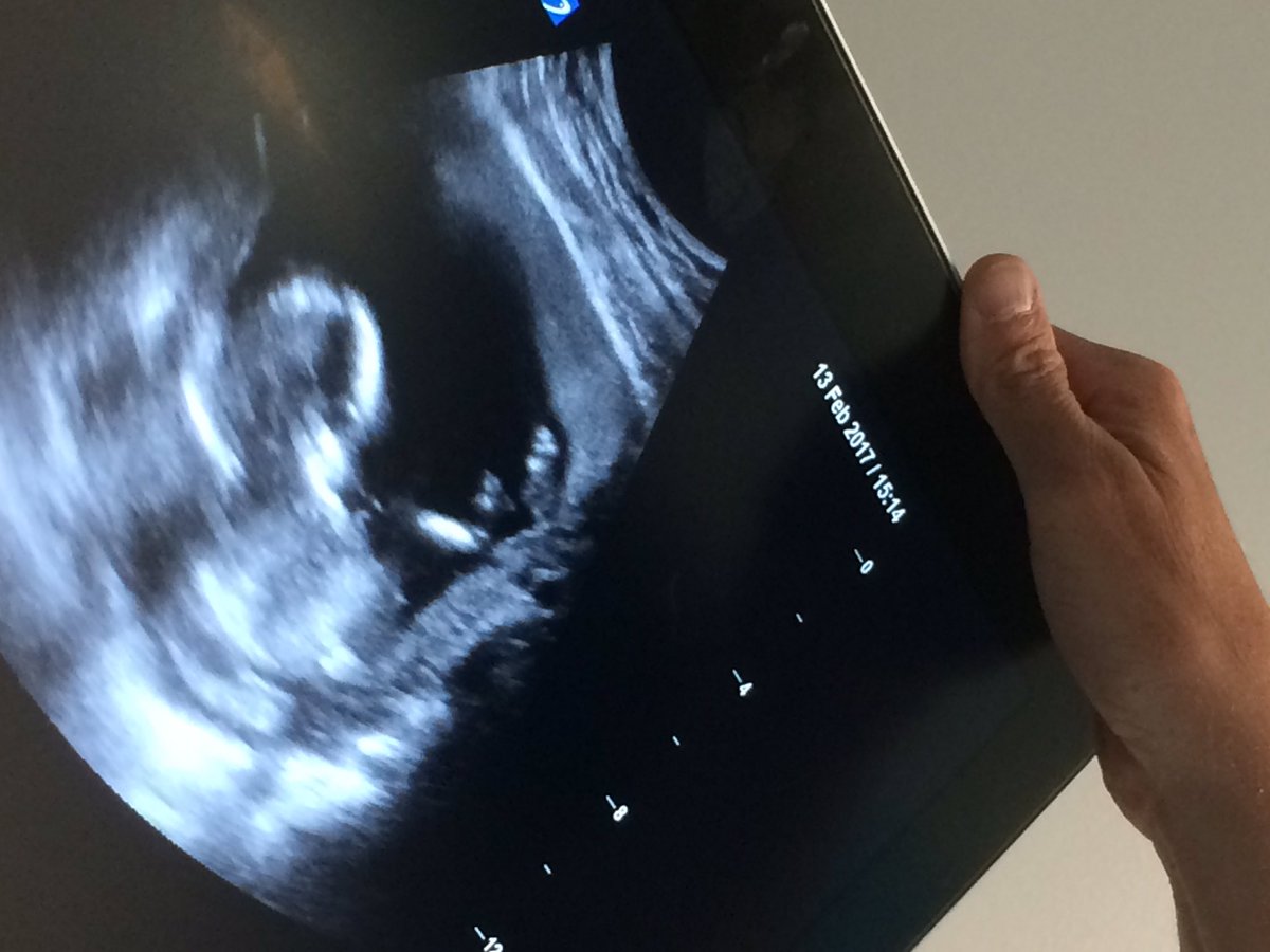 AaronDickson85's tweet photo. Going to be a dad come August! Super excited. Can't wait to get him/her their @EssendonFC gear. #firstchild #dad #efcbaby https://t.co/JwjAXgxLEK