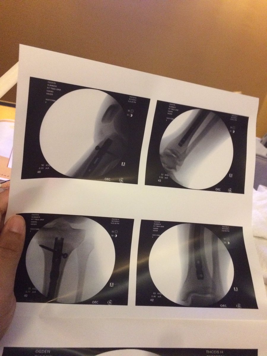 ayethree_'s tweet photo. Thanking The Man Upstairs For A Successful Surgery I Had Yesterday.❤ Beyong Blessed.
#TheReturnOf3👀 https://t.co/VBqLmKDnrG