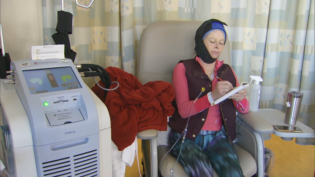 CBSEveningNews's tweet photo. Studies reveal effectiveness of cooling caps in fighting chemo-induced hair loss https://t.co/w5PEJZLxx0 https://t.co/R0MnuGj7VP