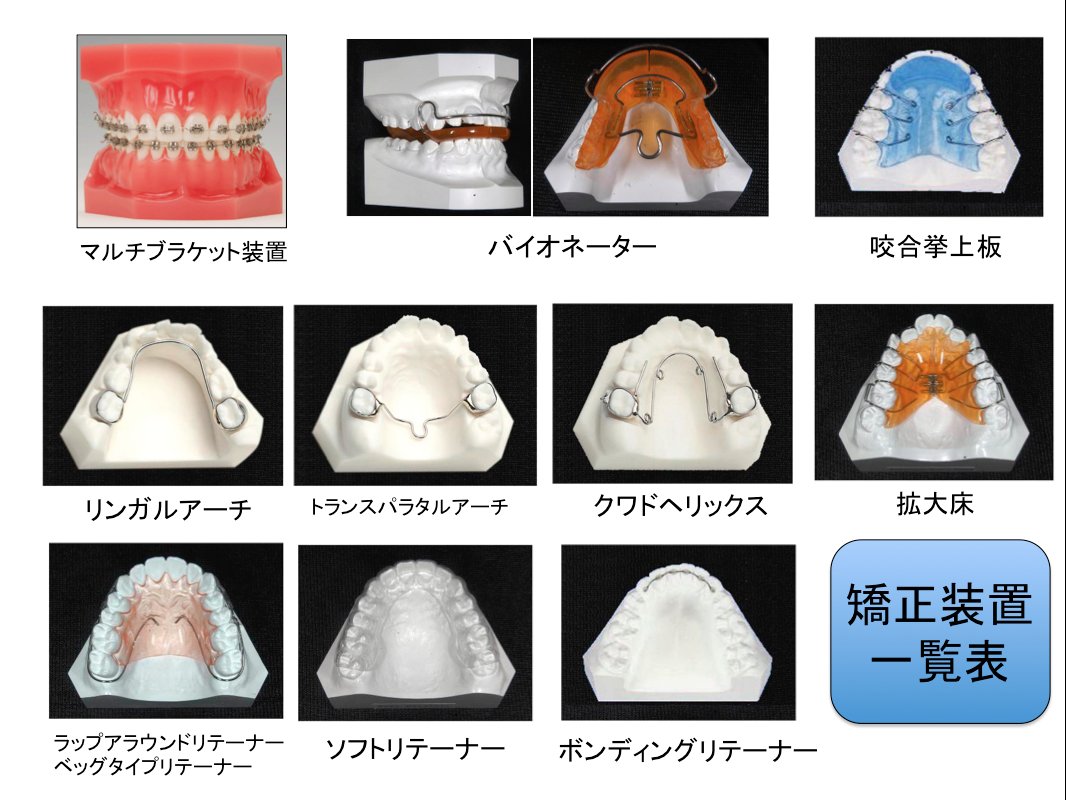 歯科医師のための一問一答 矯正装置一覧1