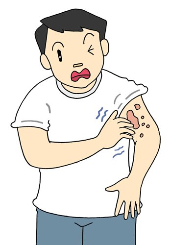 皮膚炎のtwitterイラスト検索結果 古い順 皮膚炎のtwitterイラスト検索結果 古い順