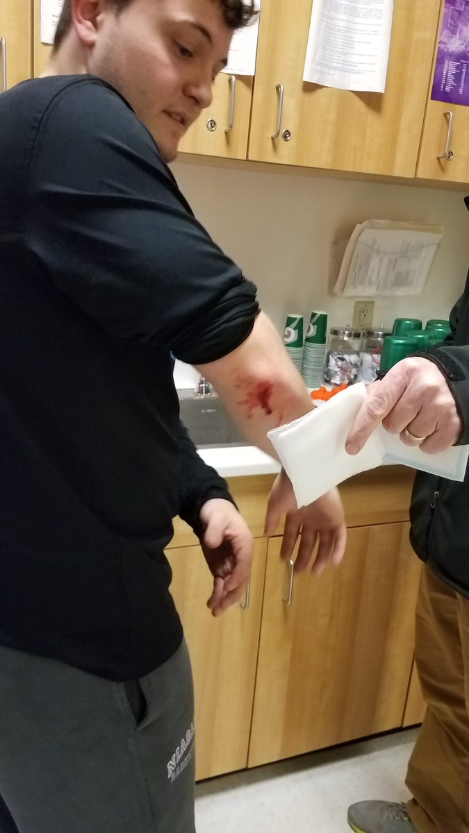 INJURY REPORT: <a href="/MattyIce_1534/">Burke</a> suffers cut on elbow after trying to act grown. Probably should've got stitches but decided to tough it out.
