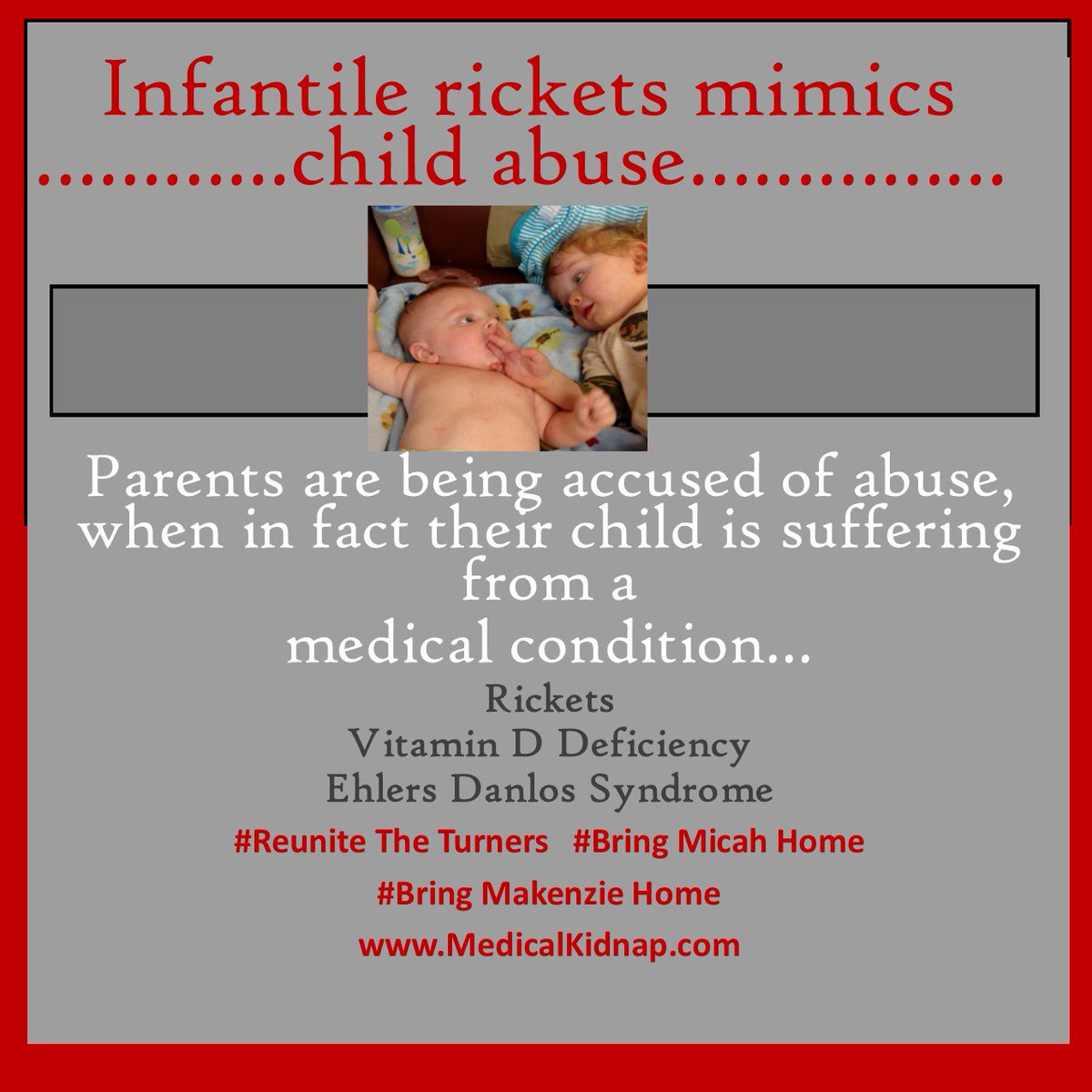 canagel007's tweet photo. Parents across the country falsely charged for child abuse when actually the child has rickets! MN couple, latest victims.@TheDrPhilShow https://t.co/3YF7FLhb3J