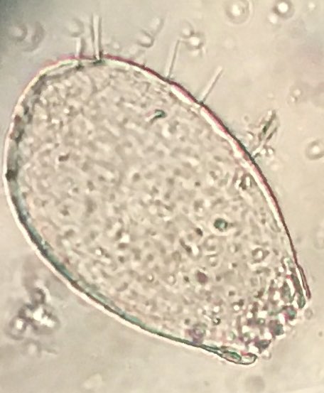 DrJoannaTindall's tweet image. Looking at testate amoebae's with @TomCBHill @CQRRHUL @RHULGeography #msclife #quatsci