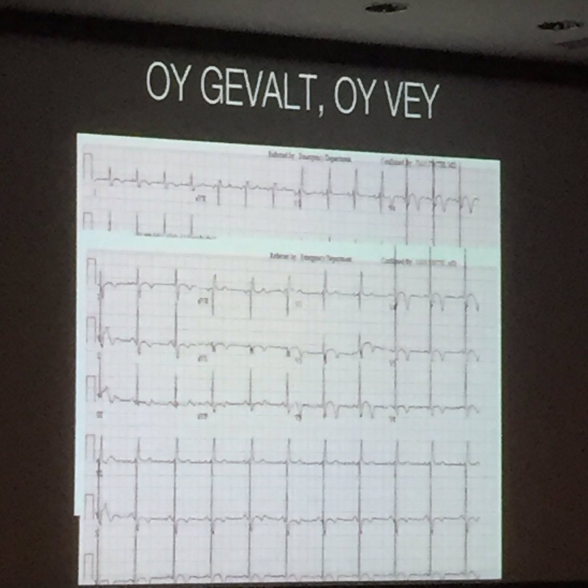 NorthwesternEM's tweet photo. PGY2 Gabby Ahlzadeh teaches us some Yiddish phrases to use on shift. #EMconf #BriefTalks https://t.co/WpPnqUaX7m