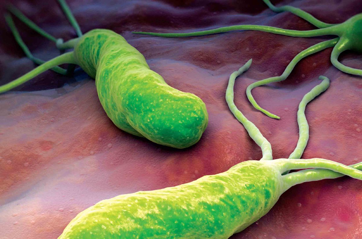 AMIposts's tweet photo. Blaser’s focus on H. pylori forms the backbone of #MissingMicrobes & is one of the book’s key strengths. Review: https://t.co/mqbXq45apG https://t.co/skaS6ZLD9L