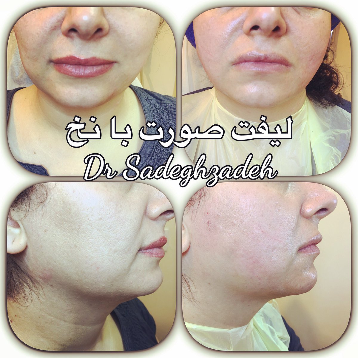 sadeghzadeh2008's tweet photo. #thread_lift #ليفت_نخ https://t.co/bpMgoJvycV